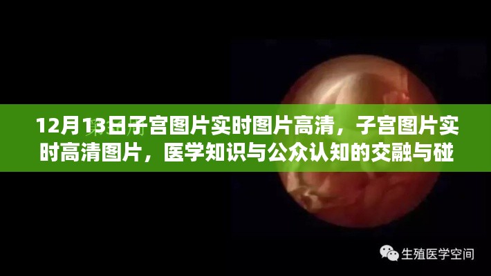 醫(yī)學知識與公眾認知交融，高清子宮圖片實時展示與探討