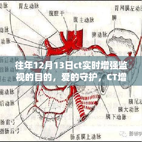 愛的守護，CT增強監(jiān)視下的暖心故事與實時增強監(jiān)視目的揭秘