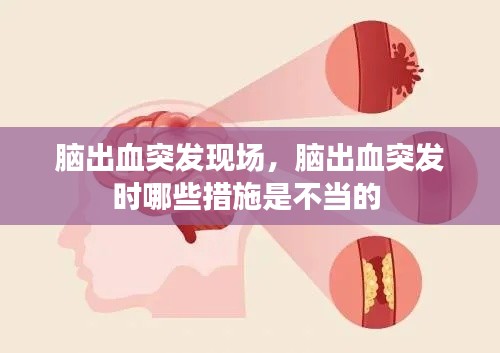 腦出血突發(fā)現(xiàn)場，腦出血突發(fā)時哪些措施是不當(dāng)?shù)?