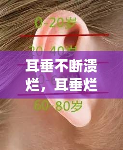 耳垂不斷潰爛，耳垂?fàn)€了怎么回事 