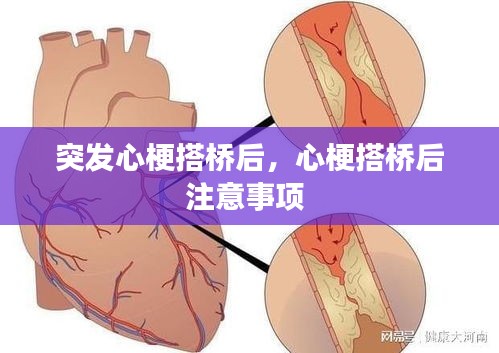 突發(fā)心梗搭橋后，心梗搭橋后注意事項(xiàng) 