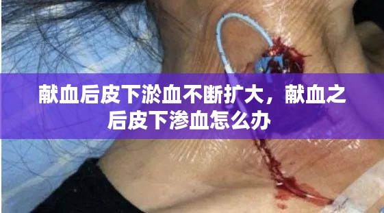 獻(xiàn)血后皮下淤血不斷擴(kuò)大，獻(xiàn)血之后皮下滲血怎么辦 