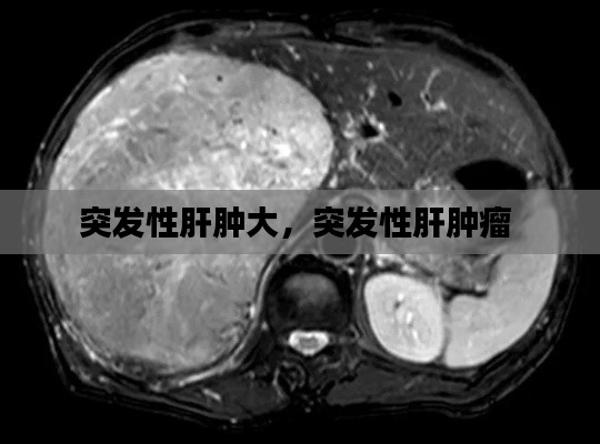 突發(fā)性肝腫大，突發(fā)性肝腫瘤 