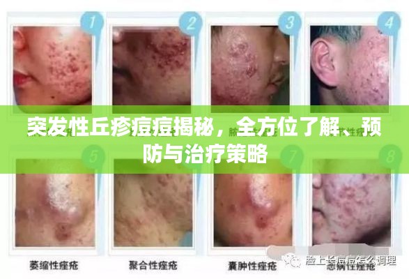 突發(fā)性丘疹痘痘揭秘，全方位了解、預(yù)防與治療策略