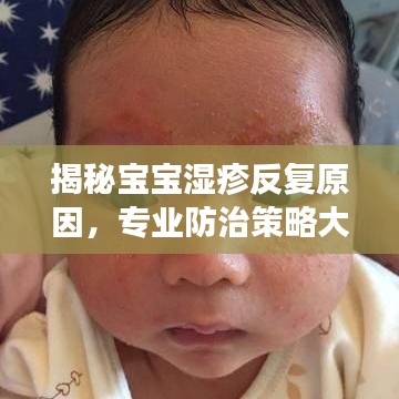 揭秘寶寶濕疹反復(fù)原因，專業(yè)防治策略大解析！
